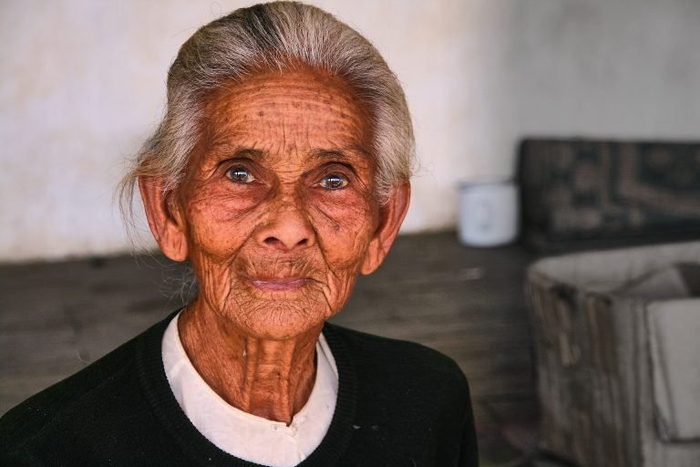 Facial wrinkles: causes and tips