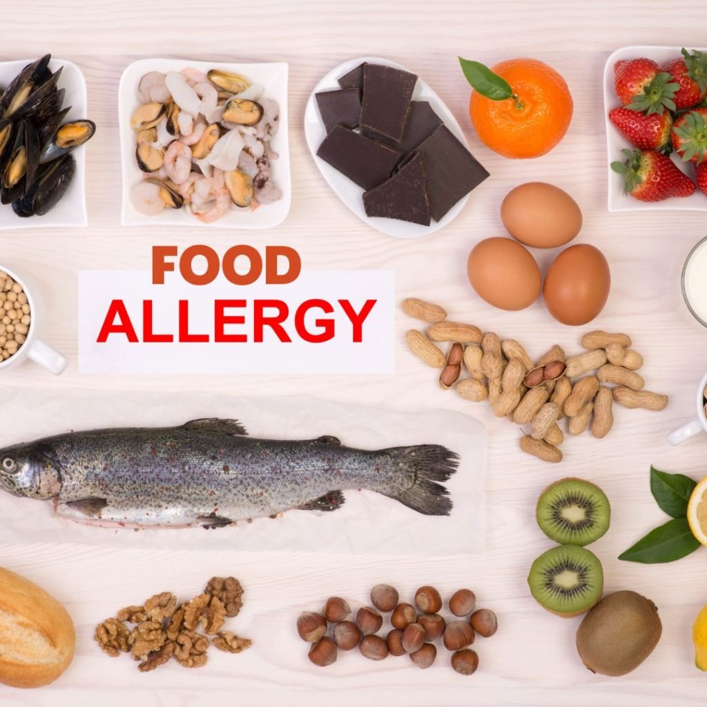 Food allergy