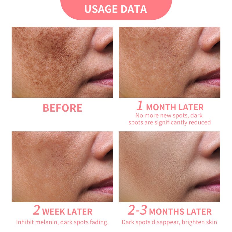 MELAO Whitening Cream for Body & Face Dark Skin Moisturizing Brighten Skin Care Products Beauty Health Body Lotion For Women Men